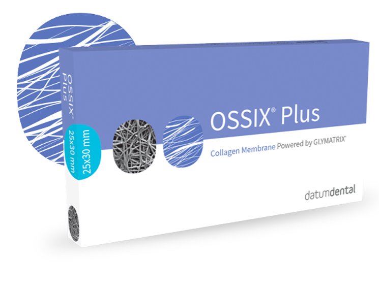 OSSIX Plus by Datum Dental