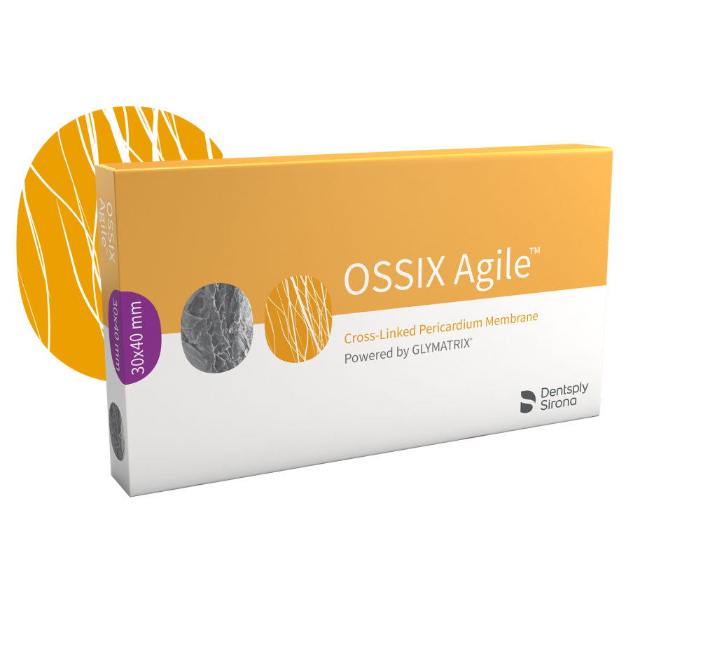 OSSIX Agile™